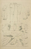 Feet – in attitude and proportions of legs