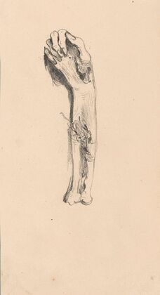 Hand and Arm