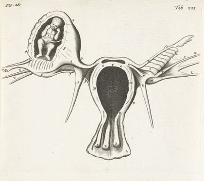Anatomical image of an ectopic pregnancy. (1672)