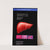Management of hepatitis C (2002) by National Institutes of Health