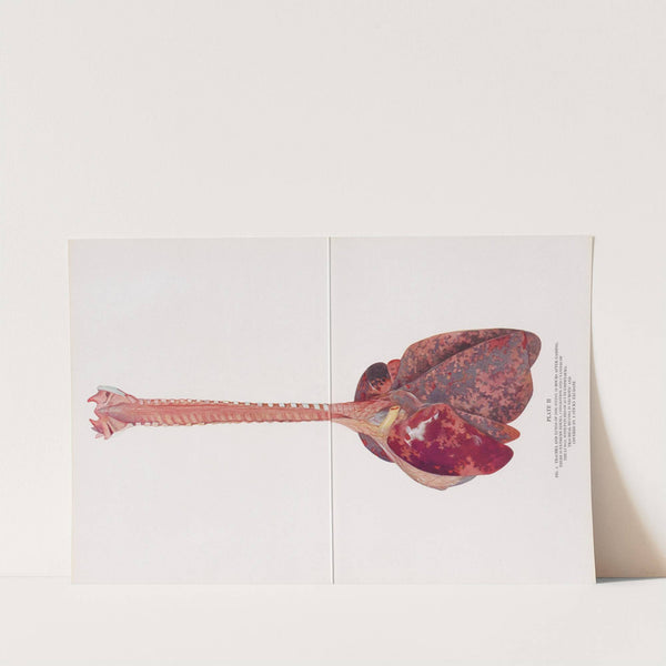 Plate II (Fig. 1): Trachea and lungs of dog dying 12 hours after gassing. by Milton C. Winternitz