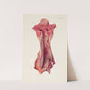 Plate IX. Ulceration of trachea by mustard gas by A. Kirkpatrick Maxwell