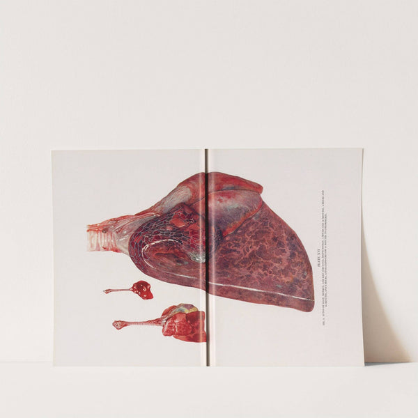 Plate XVI (Fig. 1): Lungs of goat, monkey, and rat surviving, respectively, 4 hours and 10 minutes, 4 hours and 55 minutes, and 6 hours, after exposure for 15 minutes to chlorpicrin. (1920) by Milton C. Winternitz