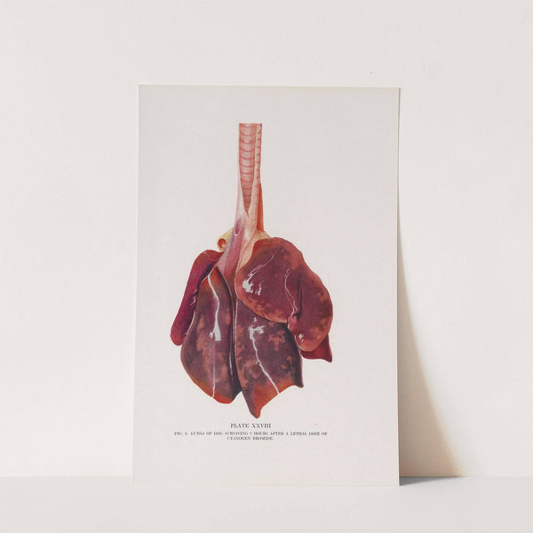 Plate XXVIII (Fig. 3): Lungs of dog surviving 7 hours after a lethal dose of cyanogen bromide. (1920) by Milton C. Winternitz