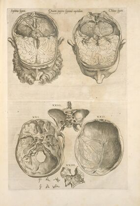 Quarta pagina figurarum capitalium [12 illustrations of the brain] — size preview