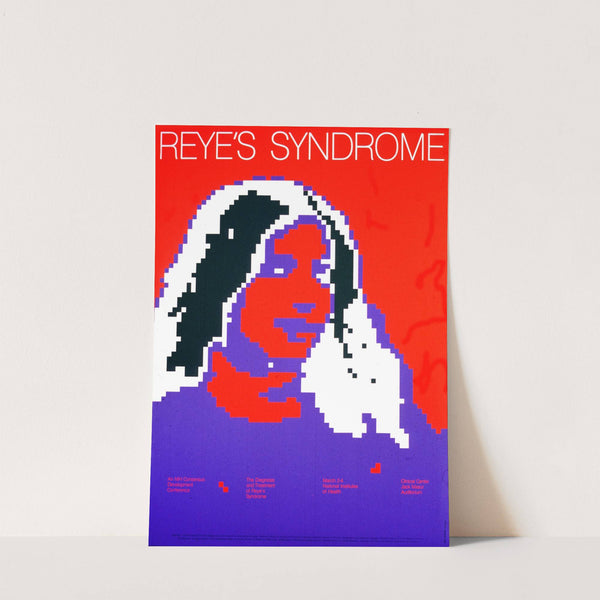 Reye&#039;s syndrome by National Institutes of Health