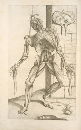 Septima musculorum tabula. [Gruesome figure hanging with a noose around its neck]