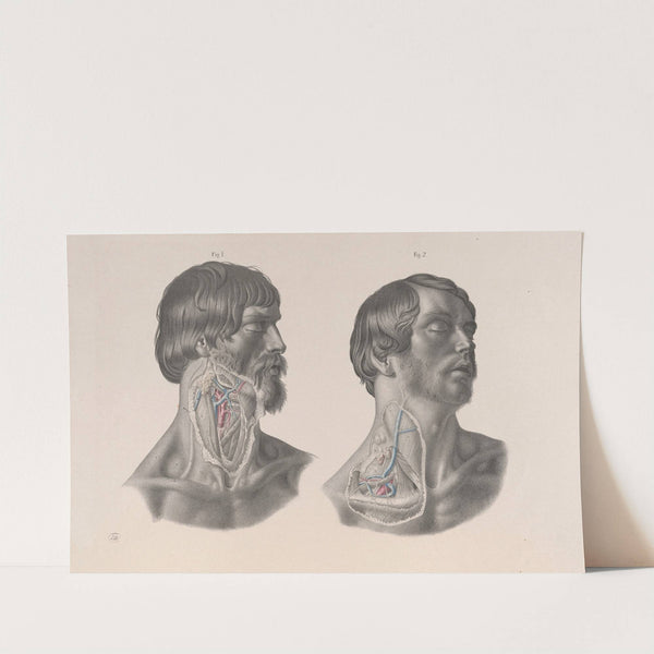 Surgical anatomy Pl.07 (1856) by Joseph Maclise