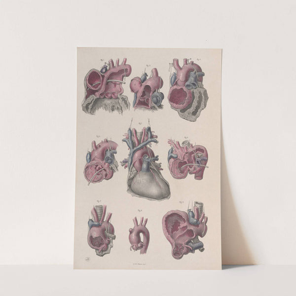 Surgical anatomy Pl.14 (1856) by Joseph Maclise