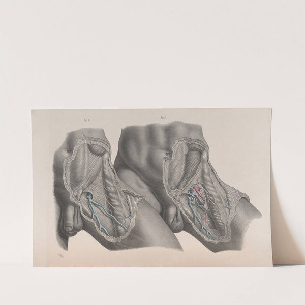 Surgical anatomy Pl.27 (1856) by Joseph Maclise