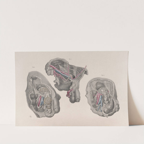 Surgical anatomy Pl.32 (1856) by Joseph Maclise