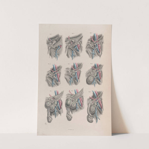 Surgical anatomy Pl.38 (1856) by Joseph Maclise