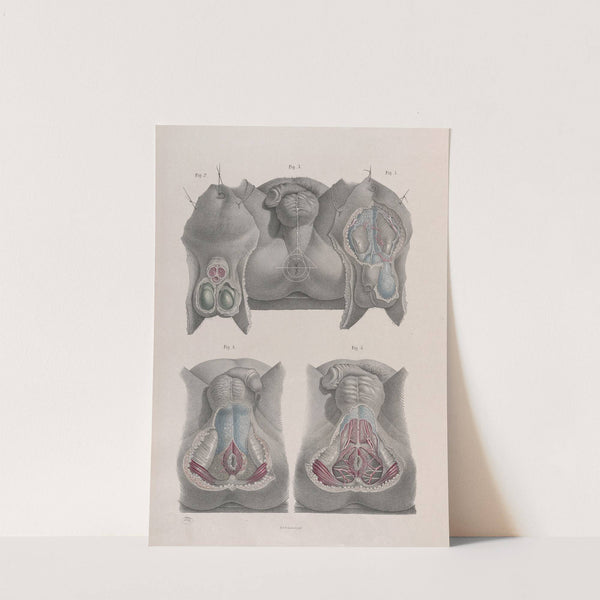 Surgical anatomy Pl.42 (1856) by Joseph Maclise