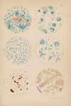 Tubercle Bacilli and Other Bacterium